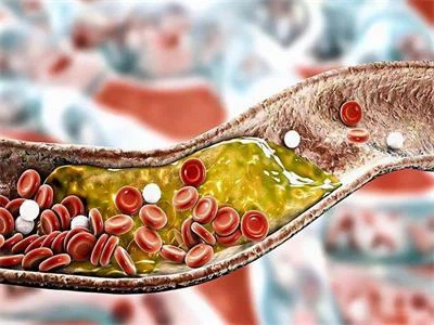 Lower cholesterol